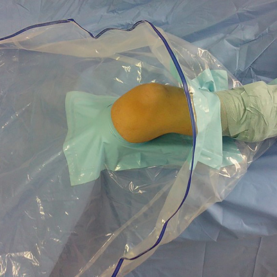 医学の使い捨て可能な外科膝のArthroscopyはパック/キットをおおう