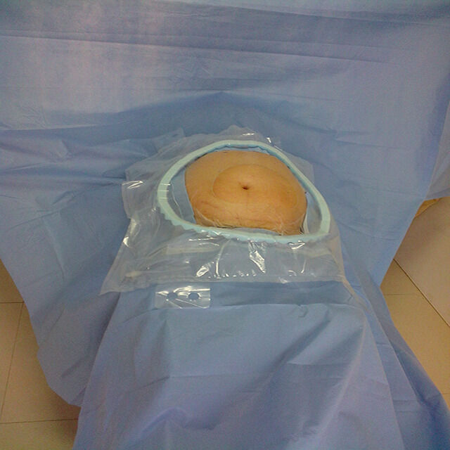 High Absorbency Disposable Surgical Packs with Reinforced Absorbent Critical Zones and EO Sterilization for Hospital Emergency